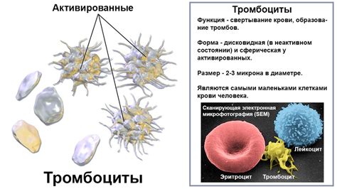 Болезни костного мозга и их влияние на показатель тромбоцитов