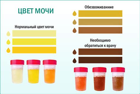 Важные факторы, способные спровоцировать изменение окраски мочи у представителей мужского пола