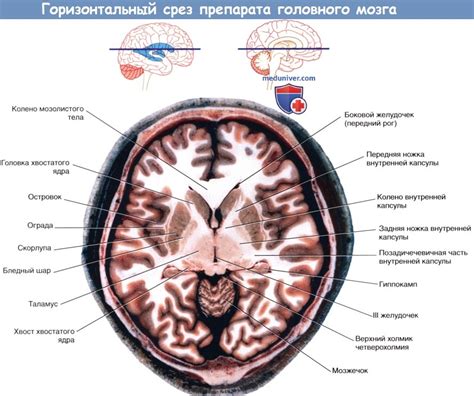 Варианты анатомического образования внутреннего круга мозга: основные аспекты