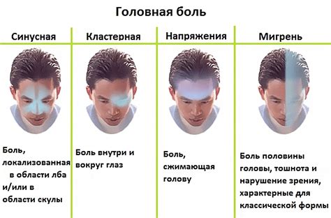 Виды головной боли: напряжение, мигрень, кластерные