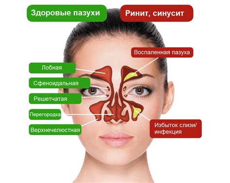 Влажный воздух - эффективный способ очистить носовые проходы