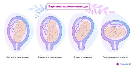 Влияние кардиоваскулярных нарушений на формирование плода в начале беременности