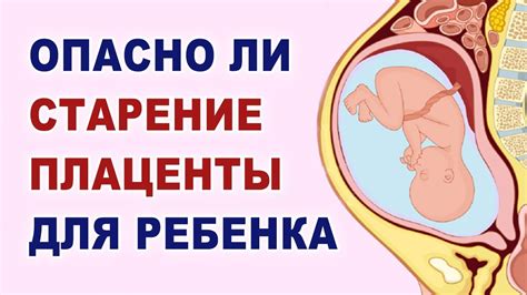 Влияние плаценты, расположенной низко, на процесс беременности