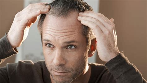 Влияние психоэмоционального напряжения на истончение волос при мужчинах