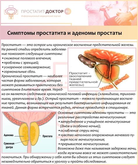 Влияние рака простаты на мужское здоровье и возможные способы предотвращения