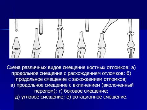 Влияние травматических повреждений и избыточной нагрузки на проявление и развитие нарушений в структуре поясничного отдела позвоночника