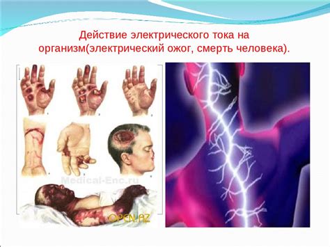 Воздействие электрического тока на человека: различные виды травм