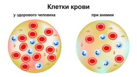 Возможные осложнения при низком уровне малых эритроцитов в крови