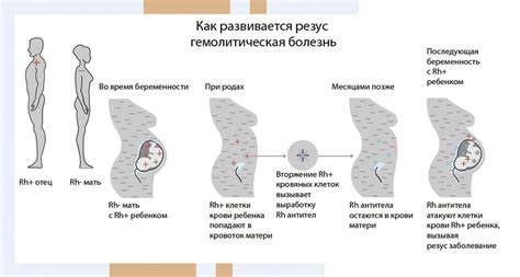 Возможные последствия резус-конфликта при недостаточной защите организма