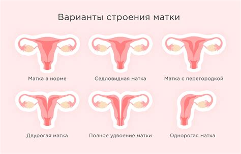 В чем заключается особенность расположения хориона в передней части матки?