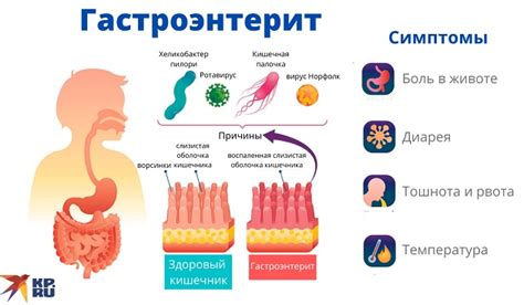 Гастроэнтерит