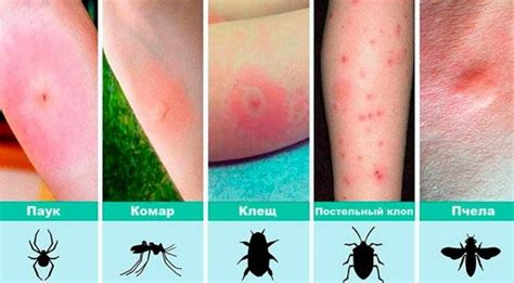 Где найти медицинскую помощь при отечности глаза после укуса мошки