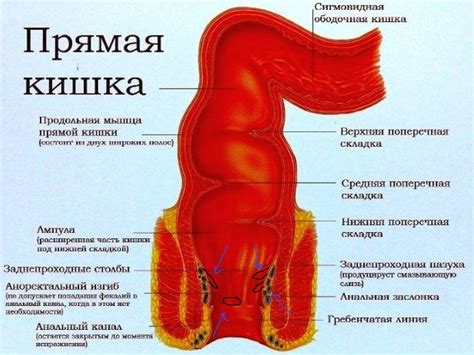 Геморрой: что следует знать о кровянистых выделениях из прямой кишки?