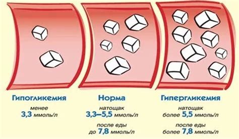 Гипергликемия у женщин: возможные причины