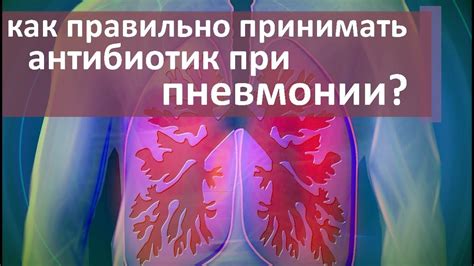 Глюкоза в капельницах при пневмонии: