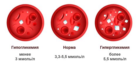 Глюкоза в сыворотке крови: что это?