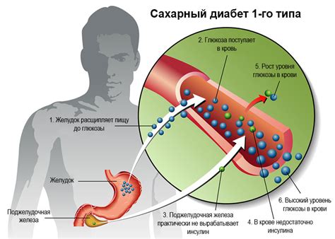 Диабет и его лечение