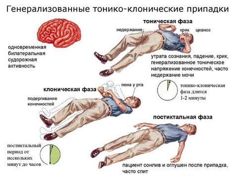 Диагностика и классификация абсансов при эпилепсии у маленьких пациентов