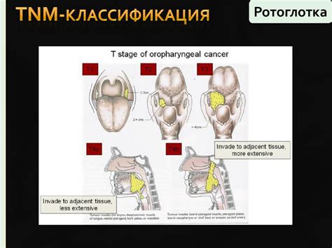 Диагностика и лечение причин дисфункции глотки