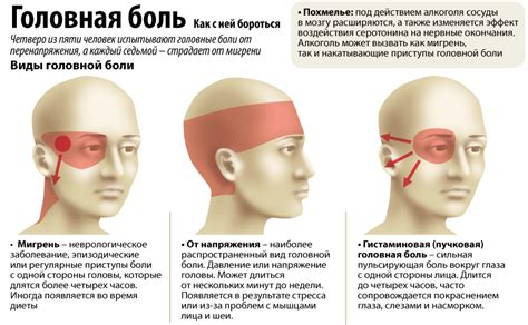 Диагностика смещения глаз на лоб