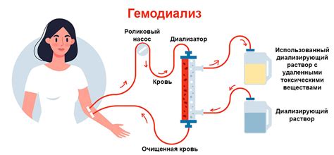 Значение гемодиализа при неисправности почек