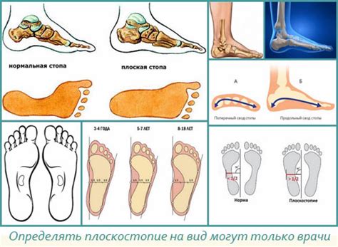 Значение среднего пальца для поддержки арки стопы и профилактики плоскостопия