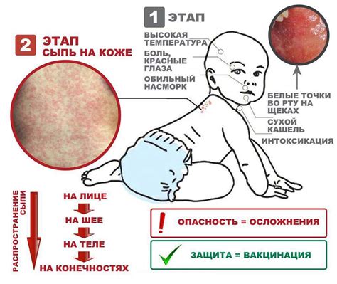 Использование специфических препаратов для облегчения кожной сыпи у детей