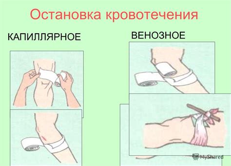 Использование хирургического клея для эффективной остановки кровотечения у домашней питомцев