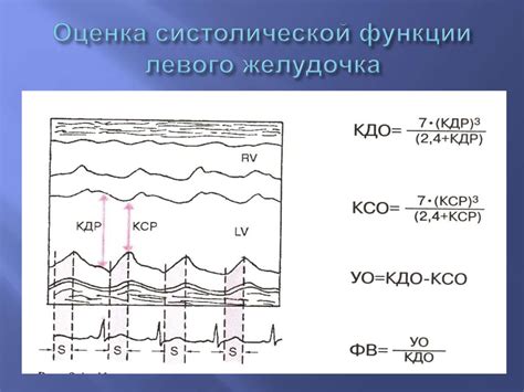 Какие аспекты влияют на сохранение глобальной систолической функции лж