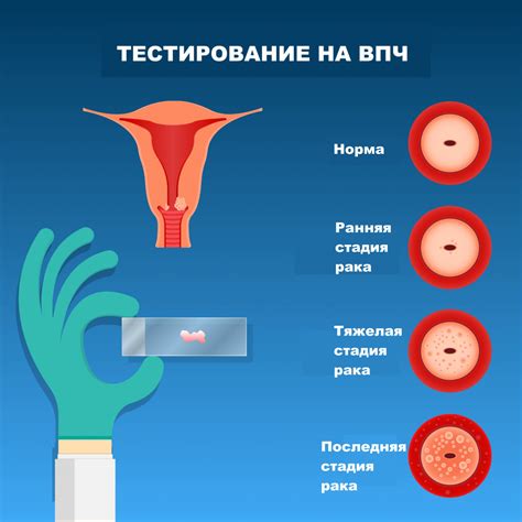 Какие признаки указывают на созревание шейки матки?