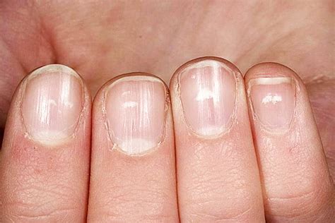 Как избавиться от нежелательной окраски на ногтях без нанесения вреда и сохранения их целостности?