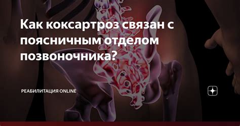 Как можно предотвратить развитие проблем с поясничным отделом позвоночника?