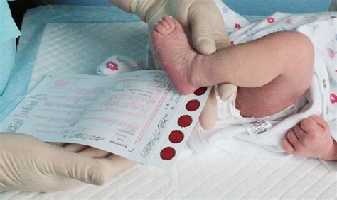Как осуществляется сбор образца крови у младенцев в родильном доме?
