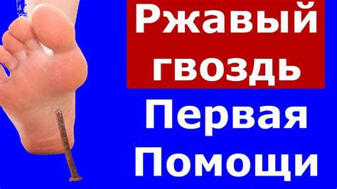 Как правильно поступить, если нога неожиданно выбивается из обуви: рекомендации и необходимый отдых