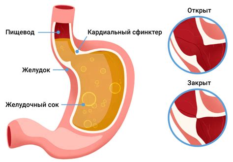 Как преодолеть страх перед гастроэзофагеальной рефлюксной фотроскопией (ГЭФГ)?