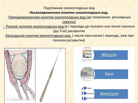 Как распознать признаки неполного отделения околоплодных вод?