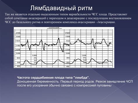 Кардиотокография в качестве метода скрининга нарушений плода