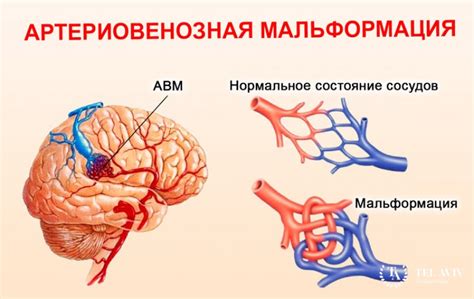 Клинические проявления резидуальной патологии мозга у маленьких пациентов