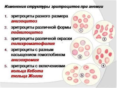 Методы лечения микроцитоза и восстановления уровня эритроцитов