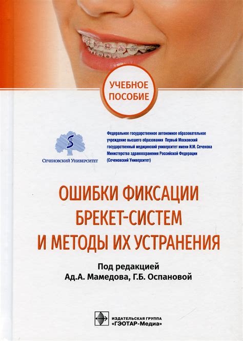 Наиболее распространенные ошибки при применении методов фиксации и способы их устранения