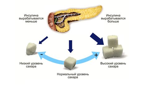 Недостаточность инсулина