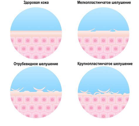 Нейрологические заболевания и повреждения