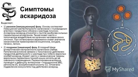 Обнаружение аскаридоза: основные признаки инфекции