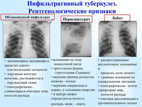 Общая информация об изменениях в легких