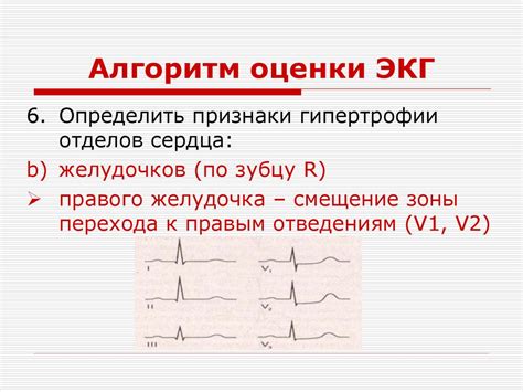 Ограничения и осложнения при анализе результатов в отведениях V1, V2 и V3