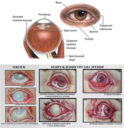 Оказание первой помощи при кровоизлиянии в глаз: советы экспертов