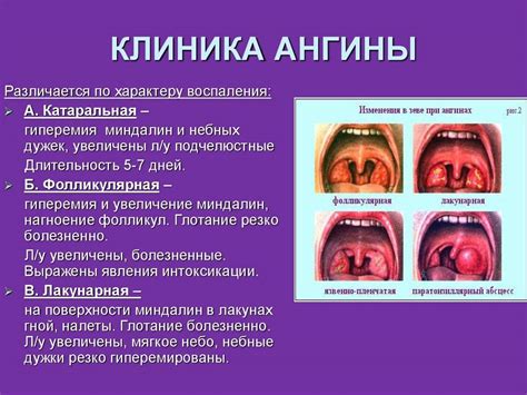 Опасности и последствия неприятного состояния горла