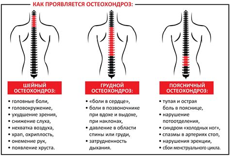 Описание степени 2 Хронической Боли в Позвоночнике