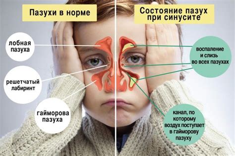 Определение затрудненного дыхания через нос у малышей: симптомы и признаки