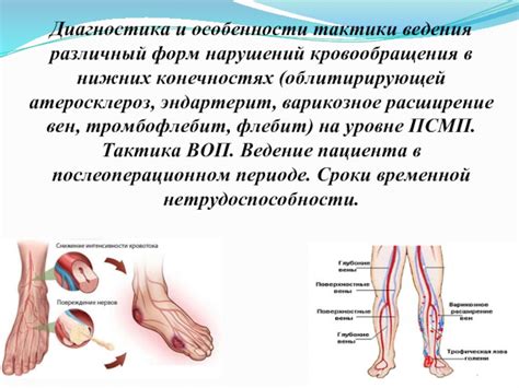 Определение корневых причин дискомфорта в нижних конечностях и нарушений сна